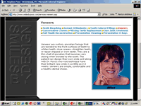 Dr. Poss Veneers