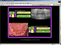 Canadian Mini Implant Institute